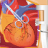 Heart Surgery 2