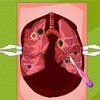 Mori's Lung Surgery Image